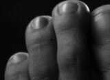 covid-toe