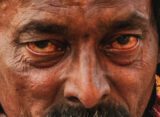 Bloodshot eyes